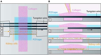 A Multitubular Kidney-on-Chip to Decipher Pathophysiological Mechanisms in Renal Cystic Diseases